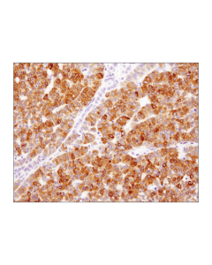 Cell Signaling Aromatase (D5q2y) Rabbit mAb