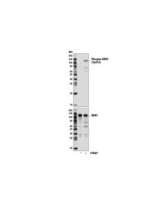 Cell Signaling Phospho-Ddr1 (Tyr513) (E1n8f) Rabbit mAb
