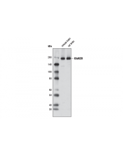Cell Signaling Nmda Receptor 2b (Glun2b) (D8e10) Rabbit mAb