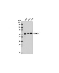 Cell Signaling Corest (D6i2u) Rabbit mAb