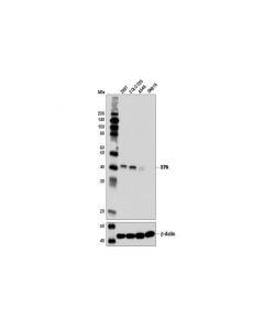 Cell Signaling Xpa (D9u5u) Rabbit mAb