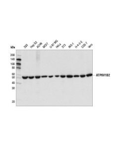 Cell Signaling Atp6v1b2 (D2f9r) Rabbit mAb
