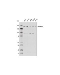 Cell Signaling Clasp2 (D5k3e) Rabbit mAb