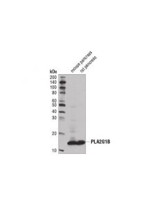 Cell Signaling Pla2g1b (D1t4c) Rabbit mAb
