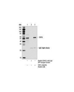 Cell Signaling Tpp1 (D4e2r) Rabbit mAb
