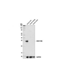 Cell Signaling Hsd17b6 (D1t5h) Rabbit mAb