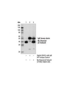 Cell Signaling Na Channel Beta2 Subunit (D1s8e) Rabbit mAb