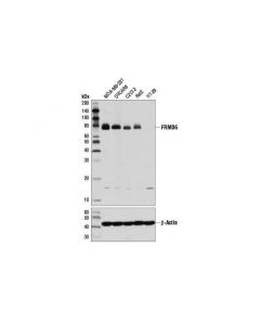 Cell Signaling Frmd6 (D8x3r) Rabbit mAb