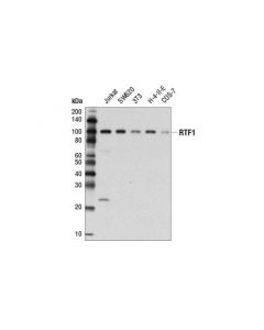Cell Signaling Rtf1 (D7v3w) Rabbit mAb