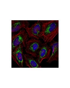 Cell Signaling Mitofusin-1 (D6e2s) Rabbit mAb