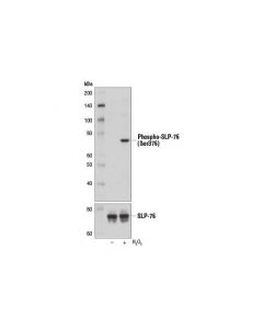Cell Signaling Phospho-Slp-76 (Ser376) (D9d6e) Rabbit mAb