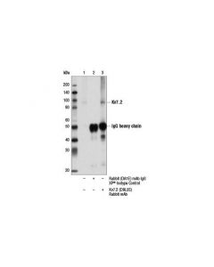 Cell Signaling Kv7.2 (D9l5s) Rabbit mAb