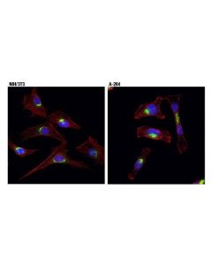 Cell Signaling Vti1a (D8u3m) Rabbit mAb