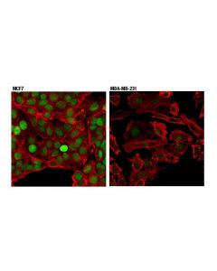 Cell Signaling Xpc (D1m5y) Rabbit mAb