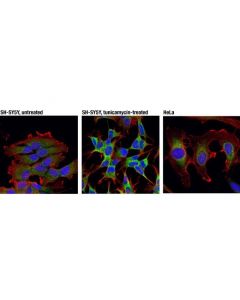 Cell Signaling Syvn1 (D3o2a) Rabbit mAb