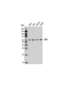 Cell Signaling Cbs (D8f2p) Rabbit mAb