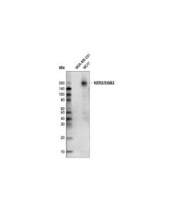 Cell Signaling Her3/Erbb3 (D22c5) Xp  Rabbit mAb (Biotinylated)