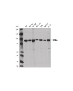 Cell Signaling Cip2a (D1m3h) Rabbit mAb