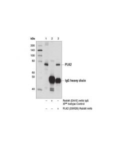 Cell Signaling Plk2 (D5r2b) Rabbit mAb