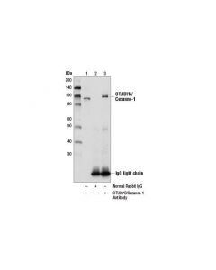 Cell Signaling Otud7b/Cezanne-1 Antibody