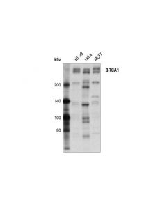 Cell Signaling Brca1 (A8x9f) Rabbit mAb