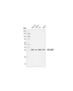Cell Signaling Sf2/Asf (D1n3s) Rabbit mAb
