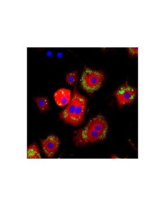 Cell Signaling Lipin 1 (D2w9g) Rabbit mAb