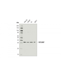 Cell Signaling Sf2/Asf (D6s7v) Rabbit mAb