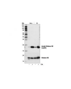 Cell Signaling Acetyl-Histone H3 (Lys23) (D6y7m) Rabbit mAb