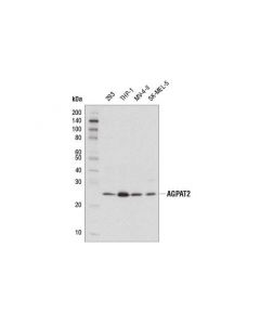 Cell Signaling Agpat2 (D8w9b) Rabbit mAb