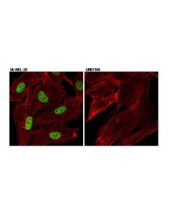 Cell Signaling P95/Nbs1 (D6j5i) Rabbit mAb
