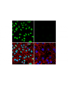 Cell Signaling Prox1 (D2j6j) Rabbit mAb
