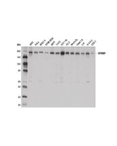 Cell Signaling Vprbp (D5k5v) Rabbit mAb