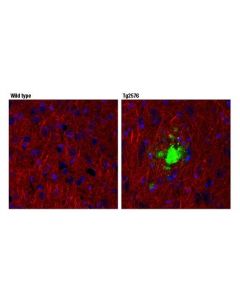 Cell Signaling Beta-Amyloid (1-42) (D9a3a) Rabbit mAb