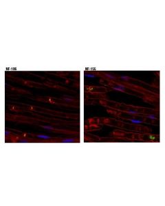 Cell Signaling Neurofascin 186 (D6g6o) Rabbit mAb