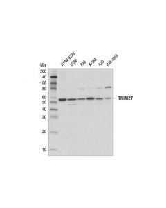 Cell Signaling Trim27 (D5s4o) Rabbit mAb