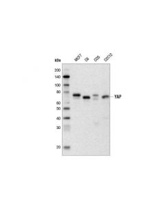 Cell Signaling Yap (D8h1x) Xp  Rabbit mAb (Biotinylated)