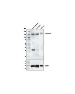 Cell Signaling F3/Contactin (D7d4x) Rabbit mAb