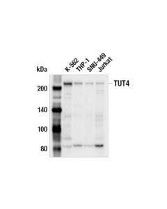 Cell Signaling Tut4 (E9d9t) Rabbit mAb