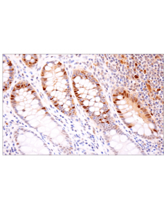 Cell Signaling Cdk2 (E8j9t) Xp Rabbit mAb