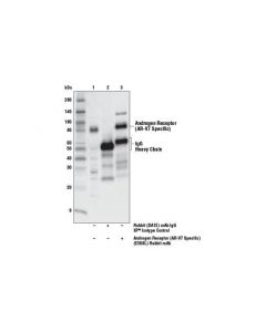 Cell Signaling Androgen Receptor (Ar-V7 Specific) (E3o8l) Rabbit mAb