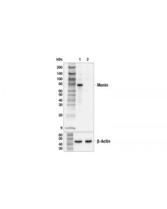 Cell Signaling Menin (E5p1r) Rabbit mAb