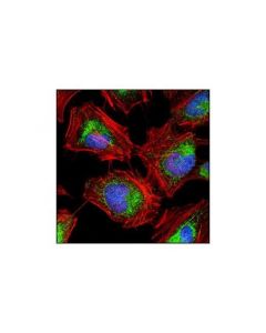 Cell Signaling Hexokinase I (C35c4) Rabbit mAb