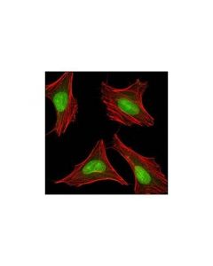 Cell Signaling Pp2a A Subunit (81g5) Rabbit mAb