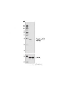 Cell Signaling Phospho-Lin28a (Ser200) (D5i6x) Rabbit mAb
