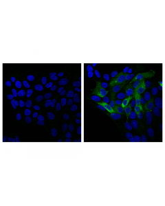 Cell Signaling Inos (E3w6b) Rabbit mAb
