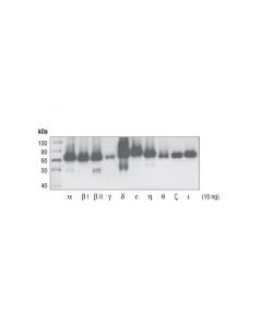 Cell Signaling Phospho-Pkc (Pan) (Zeta Thr410) (190d10) Rabbit mAb