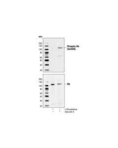 Cell Signaling Phospho-Rb (Ser608) Antibody
