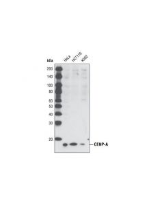 Cell Signaling Cenp-A Antibody