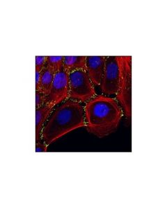 Cell Signaling P-Cadherin (C13f9) Rabbit mAb